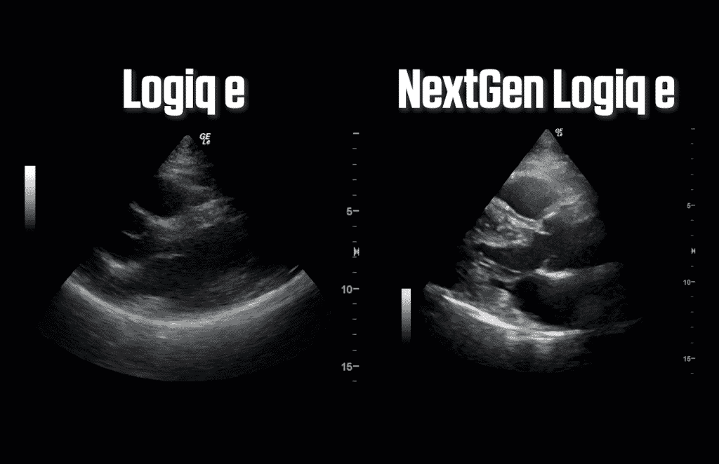 GE nextgen logiq e